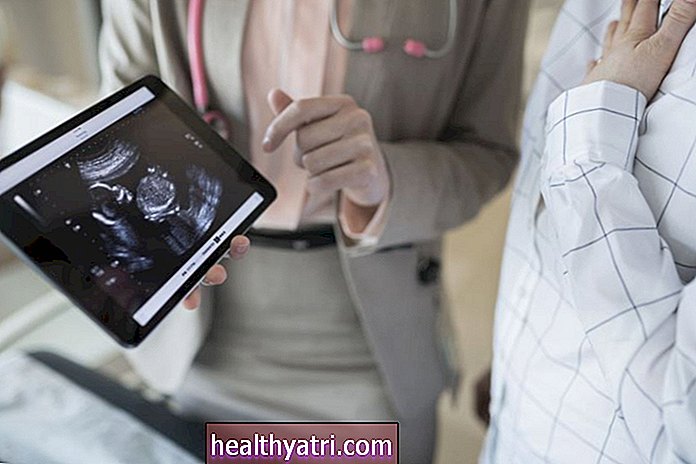 Los efectos del linfoma de Hodgkin sobre la fertilidad y el embarazo