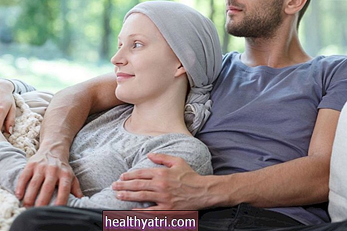 Los efectos secundarios sexuales de la quimioterapia