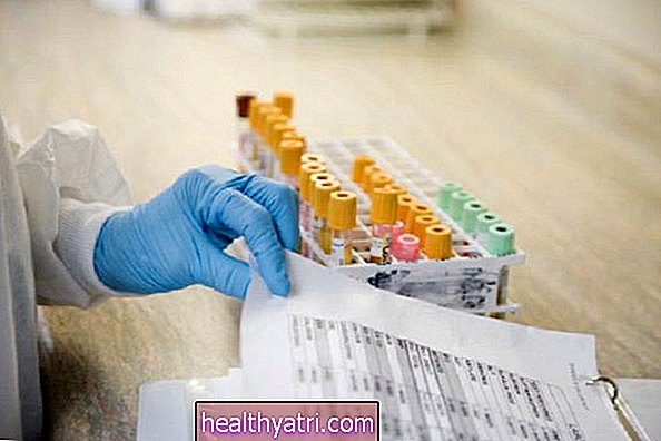 Kas ir slēpto asiņu fekāliju tests (FOBT)?