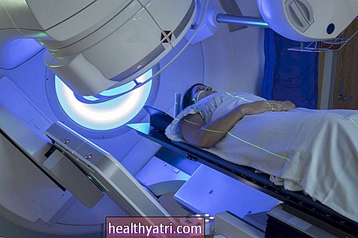 ¿Qué es un refuerzo de radiación para el cáncer de mama?