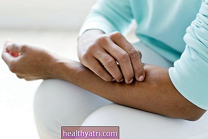 Millal on naha sügelemine vähi sümptom?