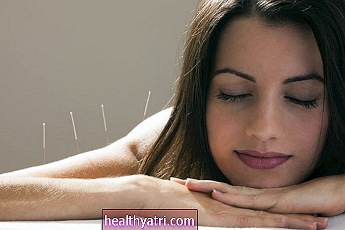 Gjør akupunktur med fibromyalgi og ME / CFS