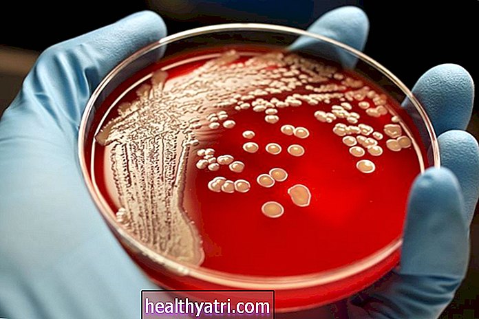 Prehľad bakteriálnych infekcií