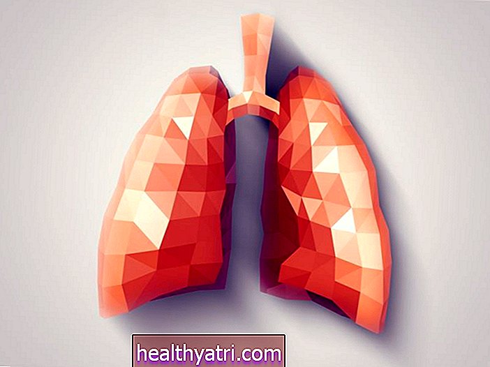 Kaip diagnozuojama bronchektazė