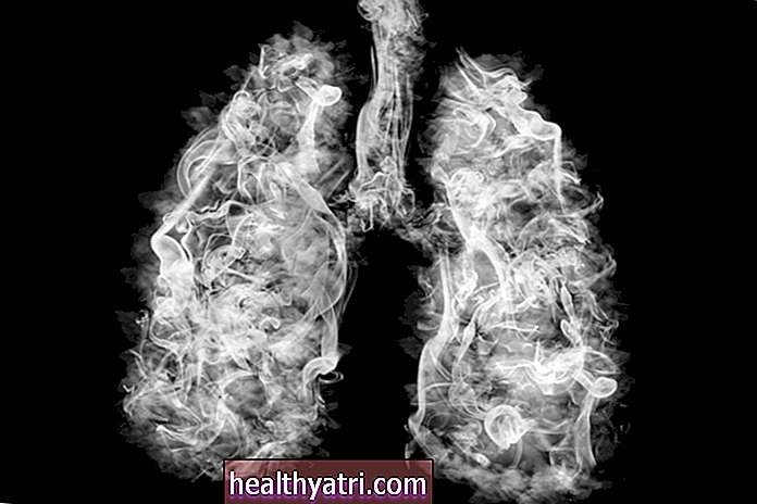 Síntomas de la infección pulmonar en la EPOC