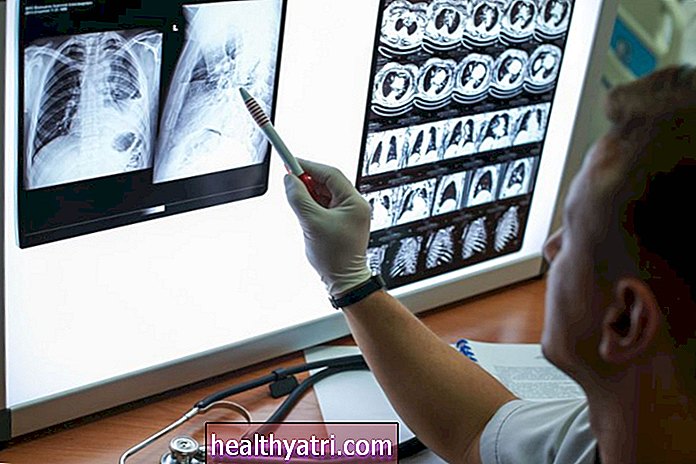 Radiografía de tórax y tomografía computarizada para COVID-19