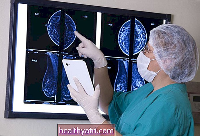 'मैमोग्राम्स सेव्ड माय लाइफ': कॉव -19 मैटर के दौरान स्तन कैंसर की जांच क्यों