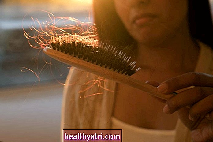 Tutkimus: COVID-19-stressi voi aiheuttaa kohonnut väliaikainen hiustenlähtö
