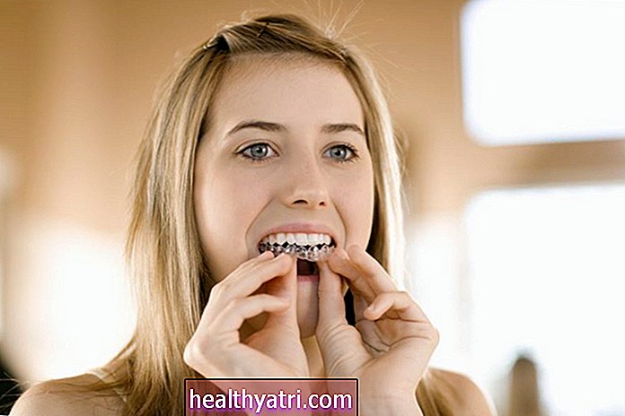 Diş Beyazlatma Hassasiyetiyle Başa Çıkmak için 10 Strateji