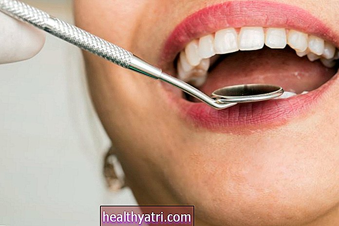 Skirtingi dantų plombavimo tipai