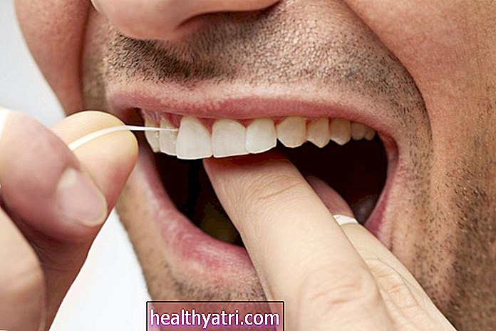 Bolezni dlesni in vaše splošno zdravje