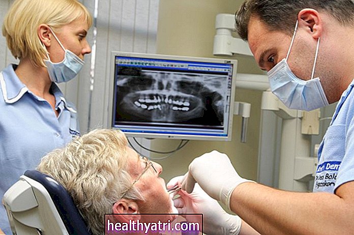 Cara Persediaan untuk Pembedahan Mulut