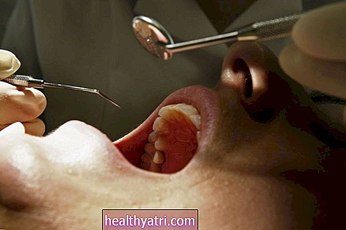 Razões para usar seu seguro odontológico antes do final do ano