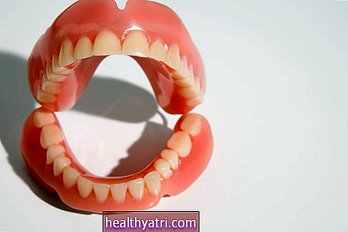 Menggantikan Gigi yang Hilang Dengan Gigi Gigi