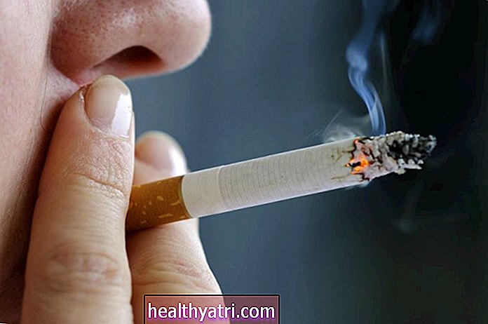 Røyking og tannproblemer