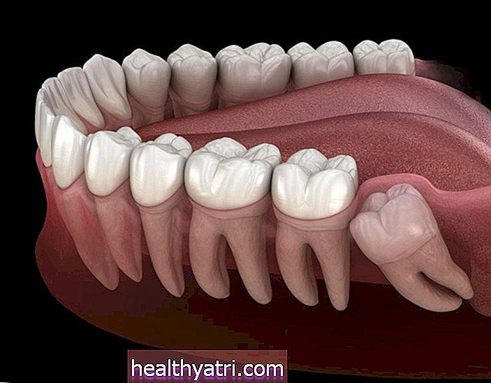 وظائف الأسنان المولية والحكمة