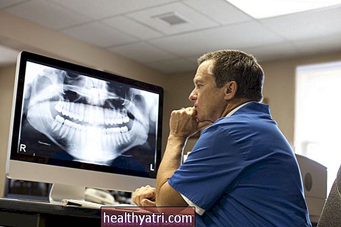 Para qué se utilizan las radiografías dentales