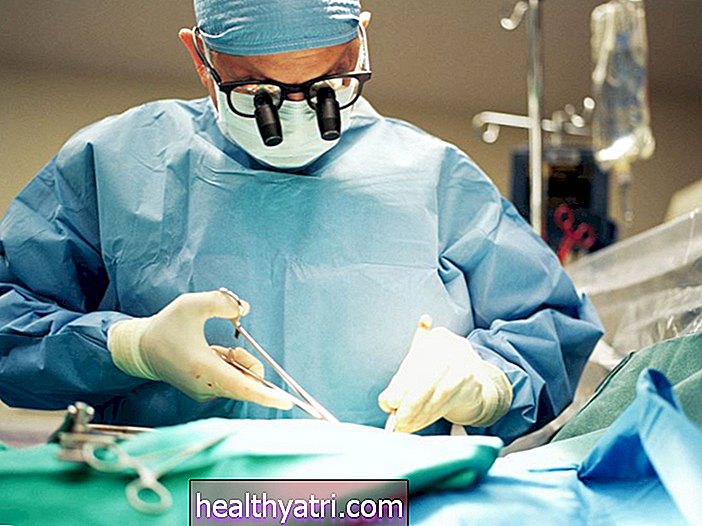 Kirurgija apendektomije: sve što trebate znati
