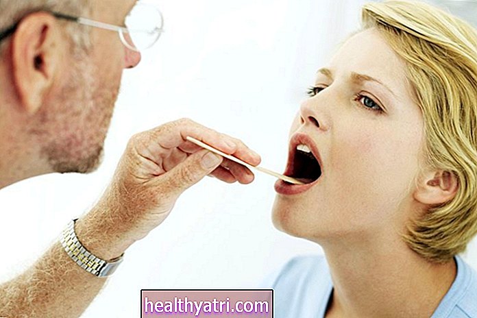 Salud Digestiva - Causas y tratamientos de la esofagitis erosiva