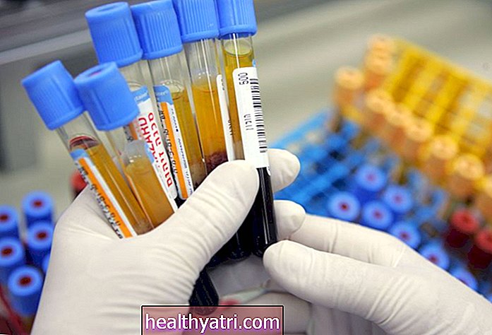 Ujian Imunokimia Fecal untuk Mengesan Darah Tersembunyi