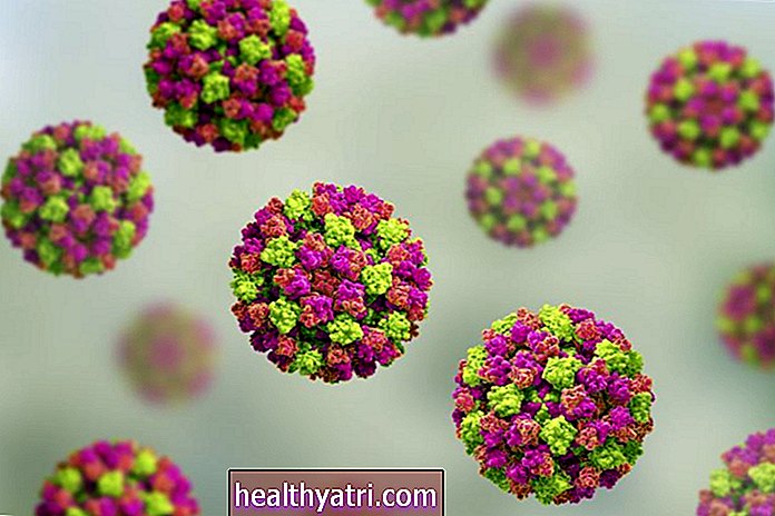 ¿Qué es el norovirus?