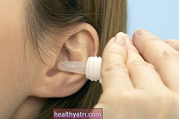 Solución ótica de antipirina y benzocaína (Aurodex) para el dolor de oído