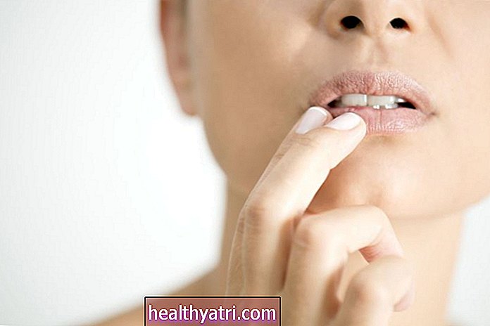 Posibles causas de hinchazón de los labios
