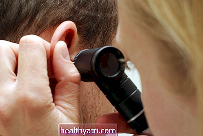 Canales semicirculares del oído