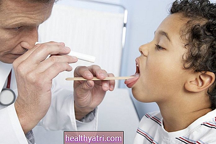 Що таке стрептокок в горлі?