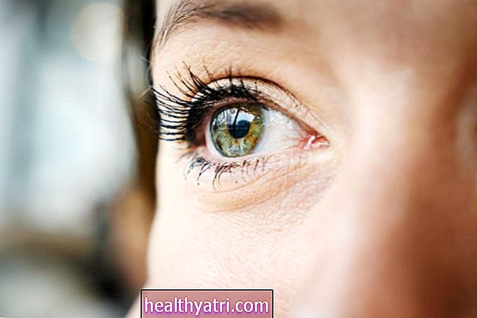 Una descripción general del síndrome del ojo seco