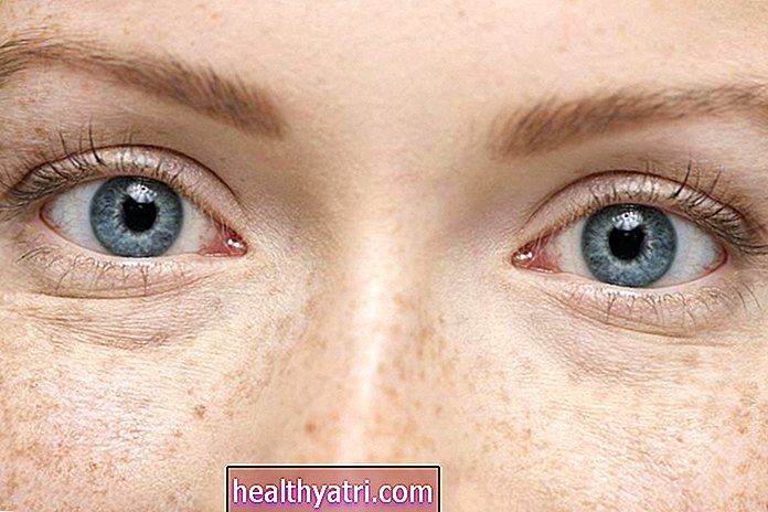 Mėlynos akys ir tavo sveikata