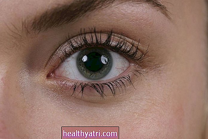 Usos de gotas para los ojos ciclopléjicos