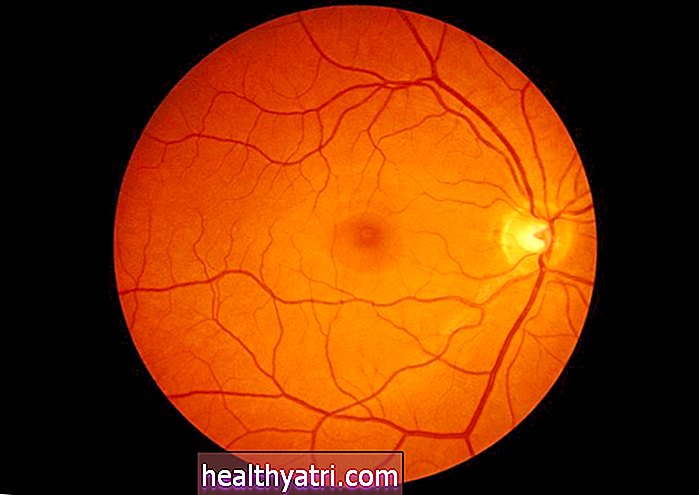 Examen ocular sin dilatación Optomap