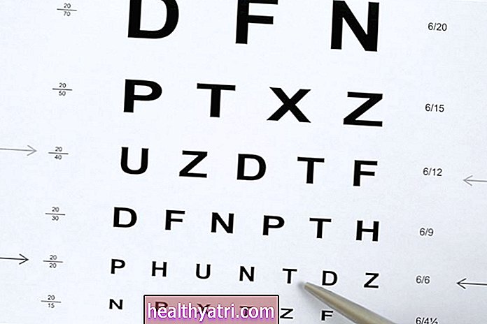 Tabla optométrica de Snellen para evaluar la visión