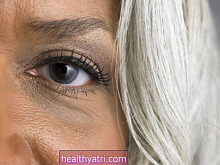Što uzrokuje mutni vid na jedno oko?