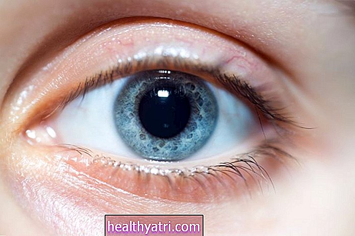 ¿Qué causa las pupilas dilatadas?