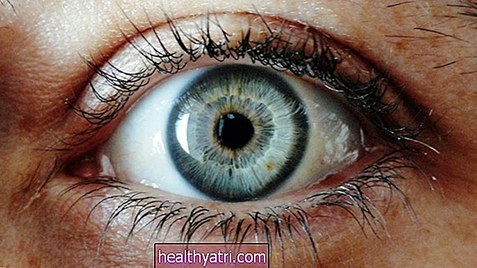 आंख फ्लोटर्स क्या कारण हैं?
