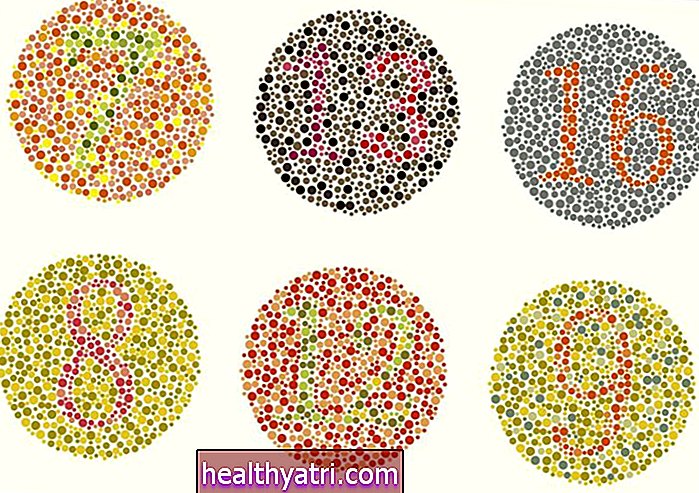 Kas yra raudonos-žalios spalvos aklųjų testas?