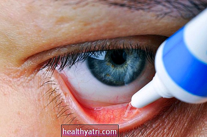 Ką reikia žinoti apie akių eritromicino tepalą
