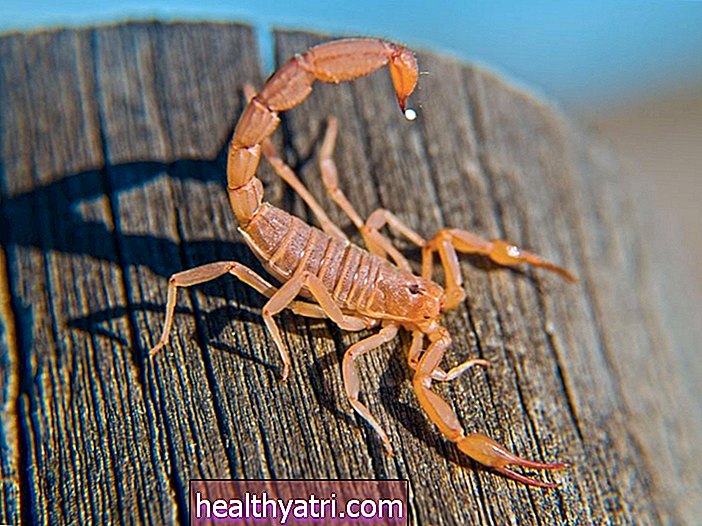 Esmaabi - Kuidas ravida skorpioni nõelamist