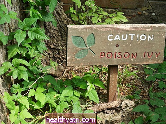 Hvordan behandle og forhindre Poison Ivy, Oak og Sumac