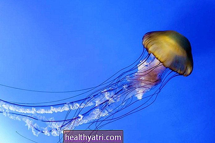 Fotos de picadura de medusa