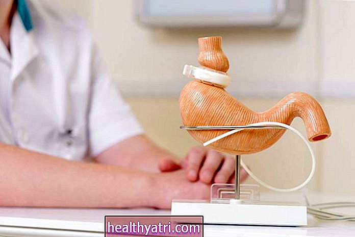 Bariatrisk kirurgi kan bidra til å forhindre et andre hjerteinfarkt hos overvektige voksne