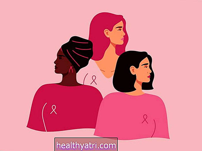 Ženski rak dojke je zdaj najpogostejši rak na svetu