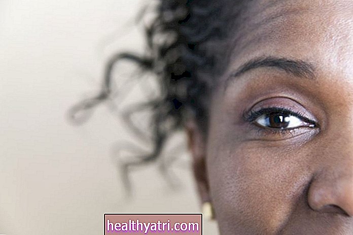 Prima săptămână de conștientizare dă lumină asupra bolilor tiroidiene ale ochilor