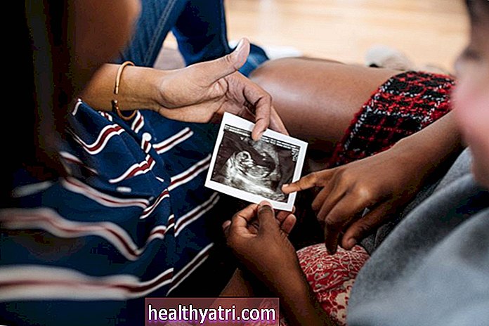 MS Onset Tertunda 3 Tahun oleh Kehamilan dan Melahirkan: Kajian