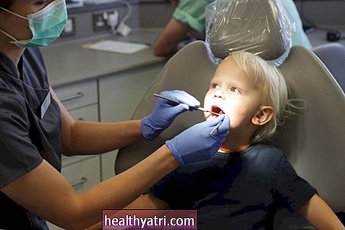 स्कूल आधारित दंत चिकित्सा कार्यक्रम 50% से गुहाओं में कमी