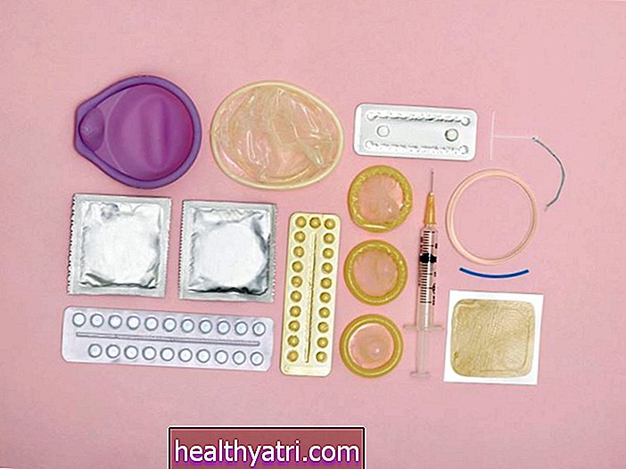 ¿Le preocupa el acceso a los métodos anticonceptivos? Esto es lo que debe saber