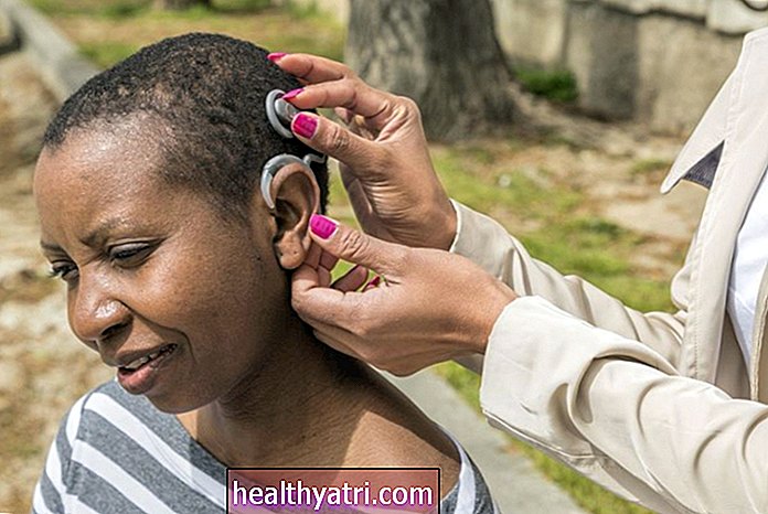 Cirugía de implante coclear para personas sordas y con problemas de audición