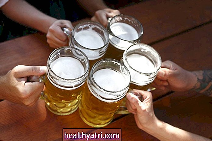 Uống nhiều có thể làm tăng nguy cơ mắc bệnh A-Fib?
